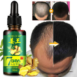 Ginger Hair Growth Essence 7 Days Germinal Hair Growth Serum Essence Oil Hair Loss Treatment Growth Hair for Men Women